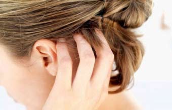 Лікування себореї шкіри голови