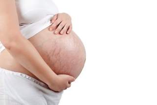 розтяжки під час вагітності