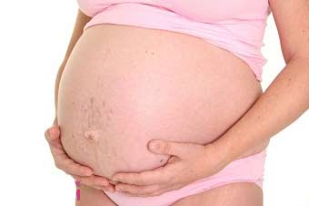 масло від розтяжок при вагітності 4