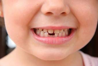 Терміни зміни молочних зубів у дітей