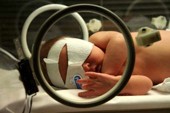 лікування жовтяниці у новонароджених