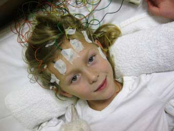 Особливості симптомів та лікувальна тактика при струсі мозку у дітей