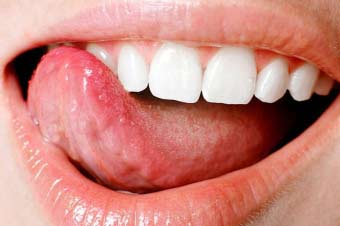 Причини оніміння язика