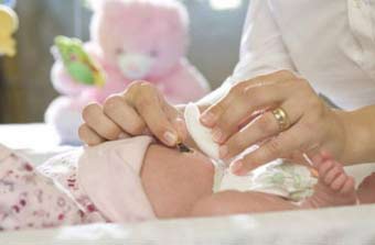 Правильна обробка пупка у новонароджених після виписки